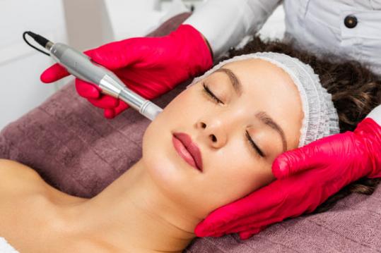 Séance microneedling