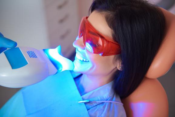 blanchement des dents