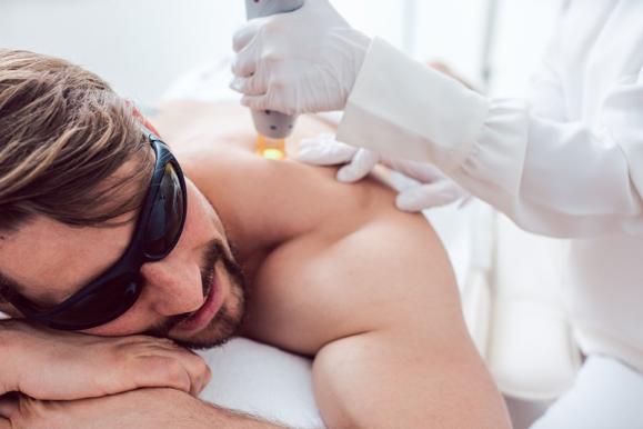 épilation définitive au laser