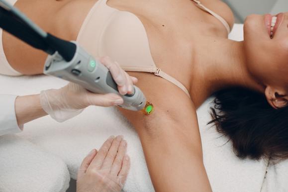 Pourquoi choisir l'épilation laser plutôt que l'épilation à la lumière pulsée?