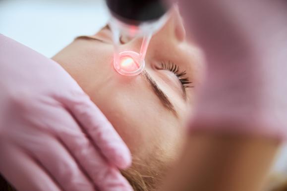 rajeunissement laser du visage