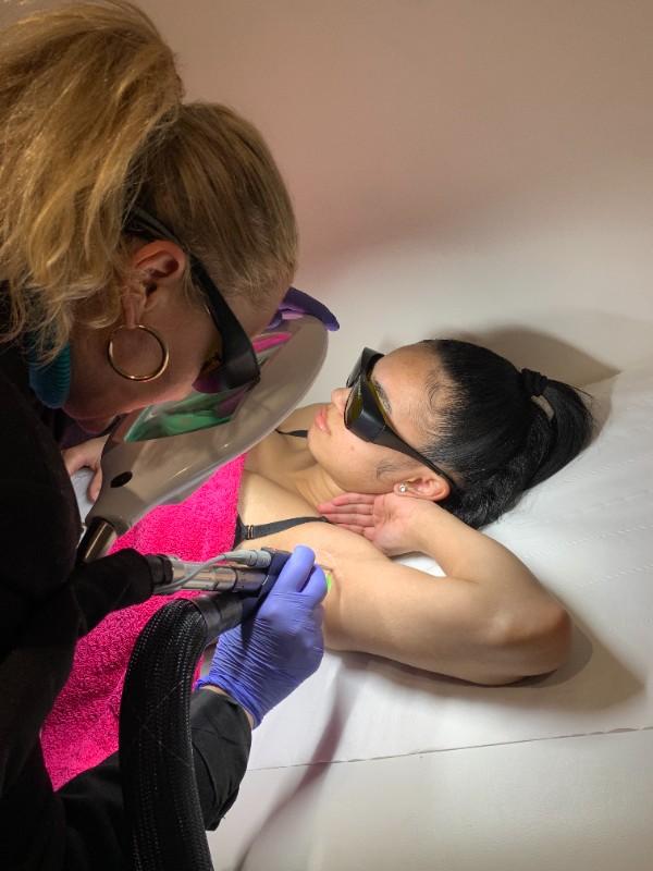 Épilation Laser à la Rentrée : Le Moment Idéal, Même avec un Bronzage !