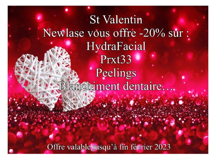 Quelle idée de cadeau pour la saint valentin ?